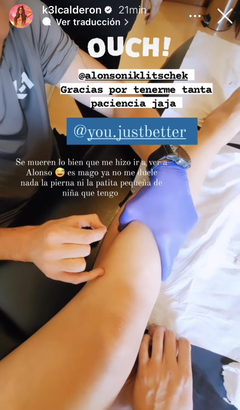 Kel Calderón feliz con su reciente tratamiento con agujas