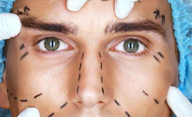 Cirugías plásticas