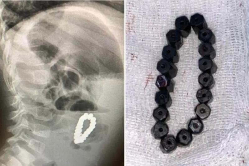 Ecografía del niño -New York Post