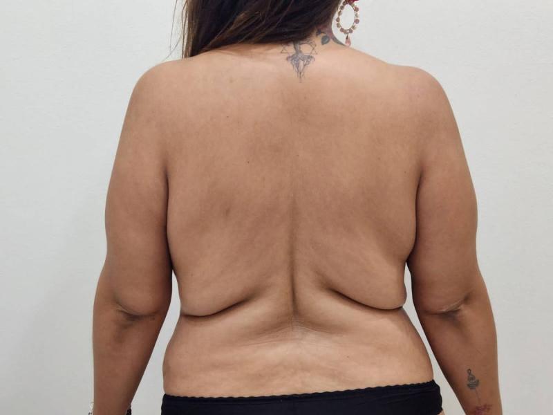 "Escandaloso cómo se ha notado": Pamela Leiva se sometió a especial tratamiento estético para su debut en Viña 2023