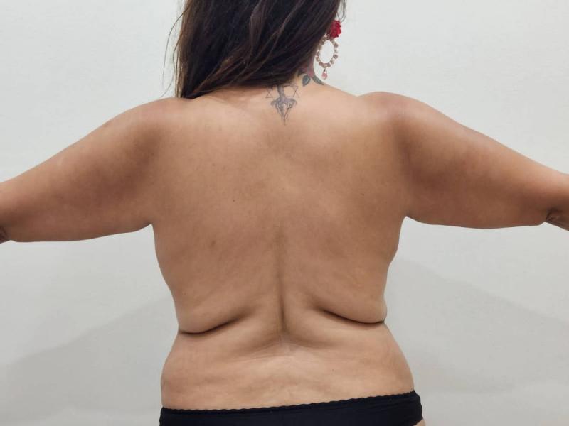 "Escandaloso cómo se ha notado": Pamela Leiva se sometió a especial tratamiento estético para su debut en Viña 2023