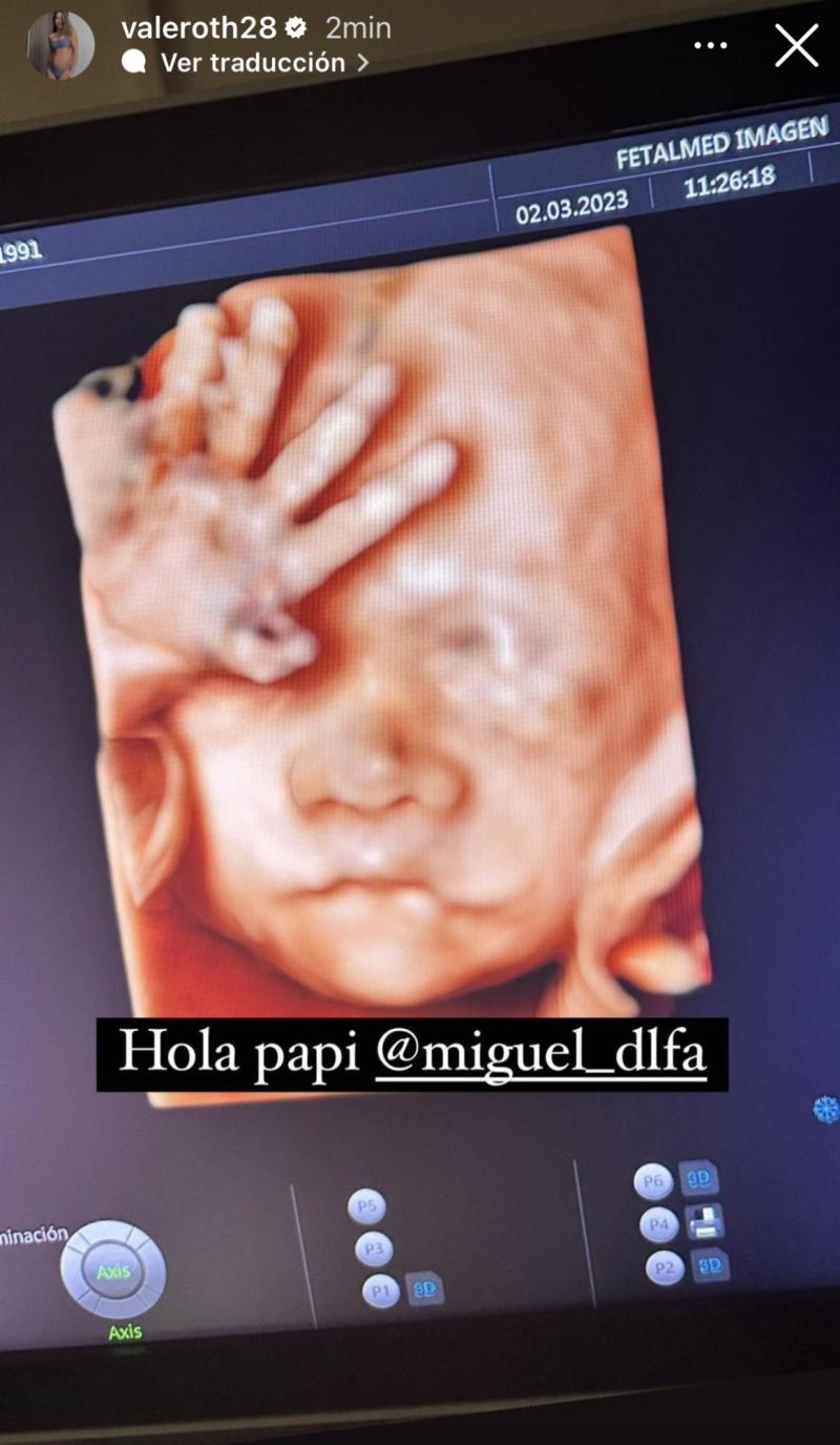 Vale Roth - Instagram