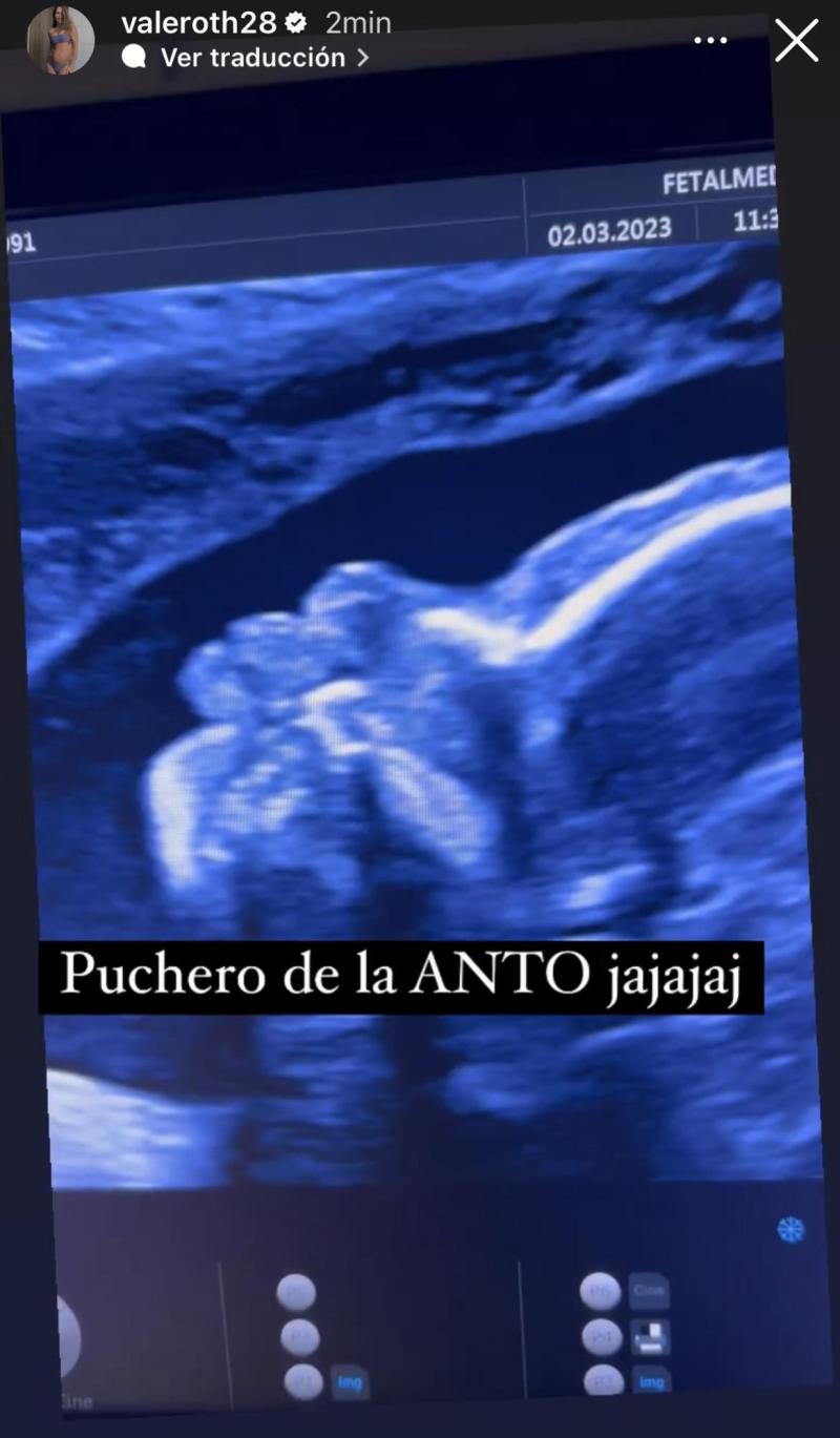 Vale Roth - Instagram