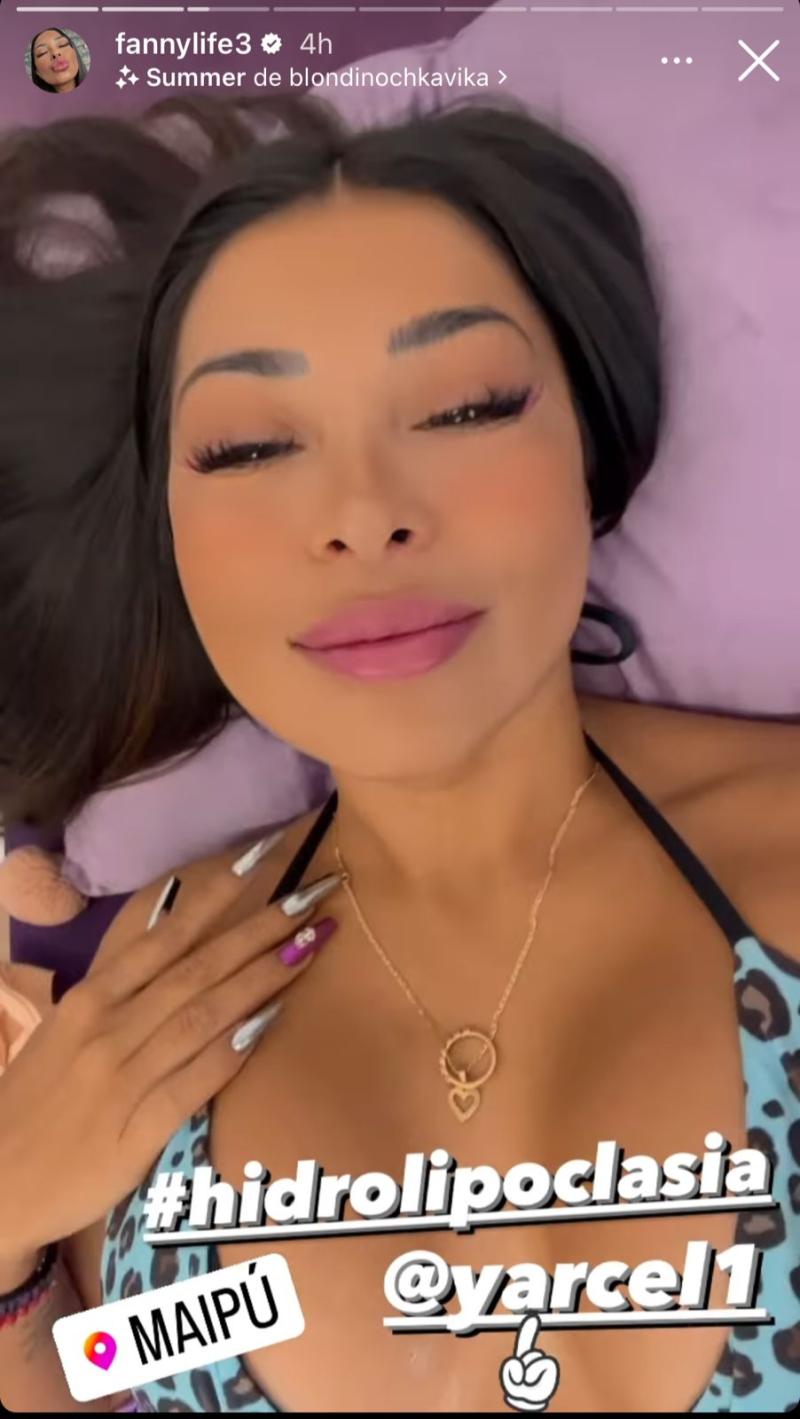 Fanny Cuevas se sometió a tratamiento corporal