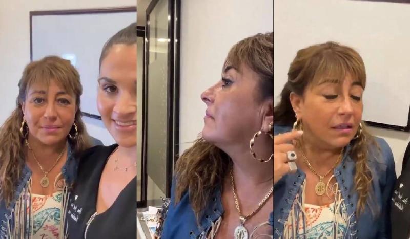 Historia de Helhue Sukni mostrando el resultado de su retoque facial