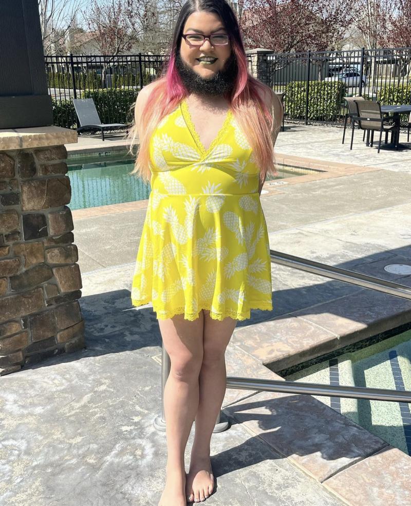 Mujer dejó crecer su barba y así luce en la actualidad