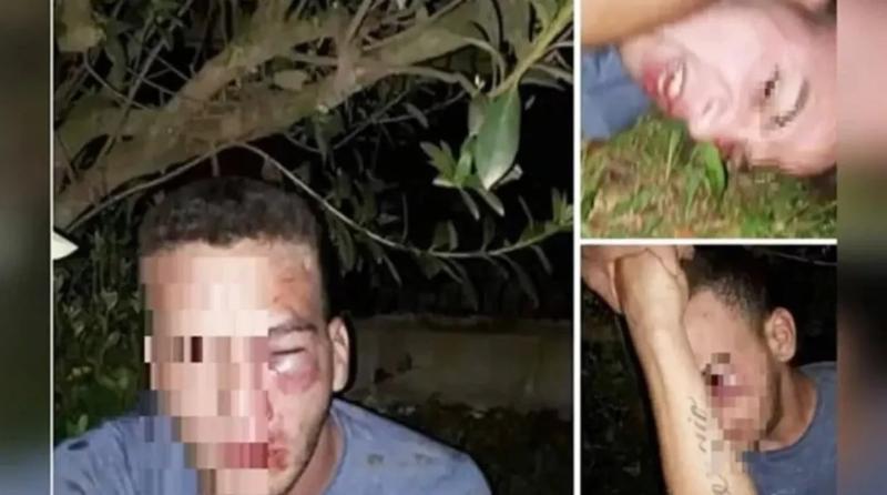 Hombre argentino acusado de Grooming con la cara desfigurada