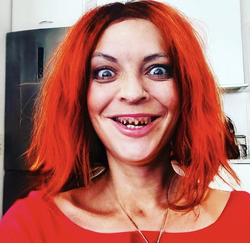 Hijo de Camilo Sesto muestra su nueva sonrisa