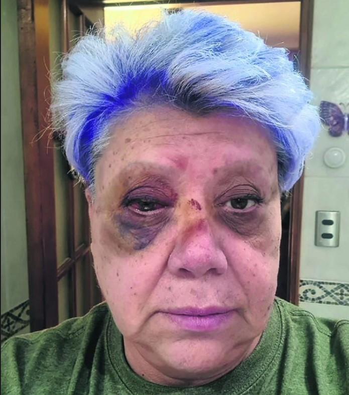 Rostro de Paty Maldonado tras su accidente