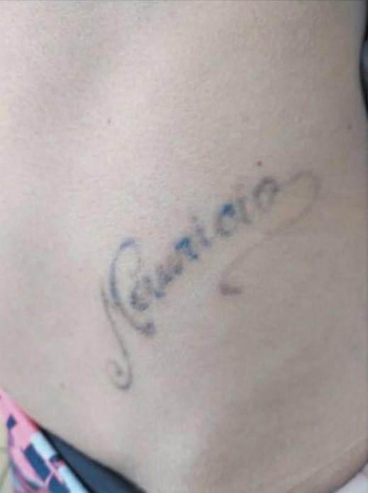 Tatuaje de Gissella Gallardo casi borrado