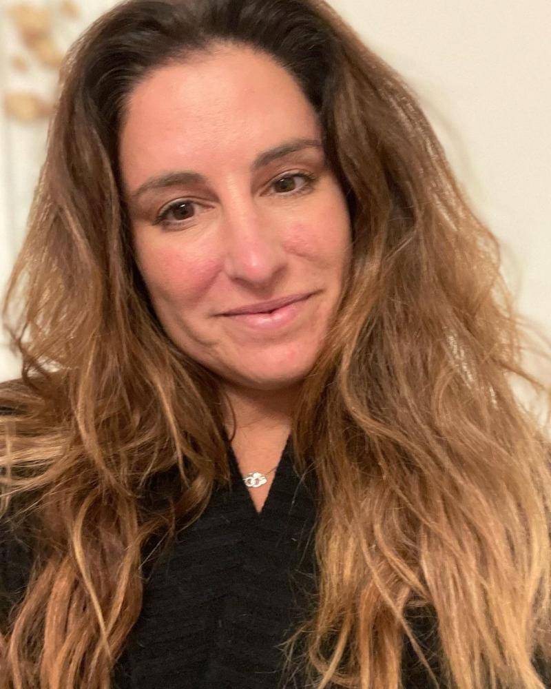 Fran Sfeir mostró su rosácea en fotos sin filtro