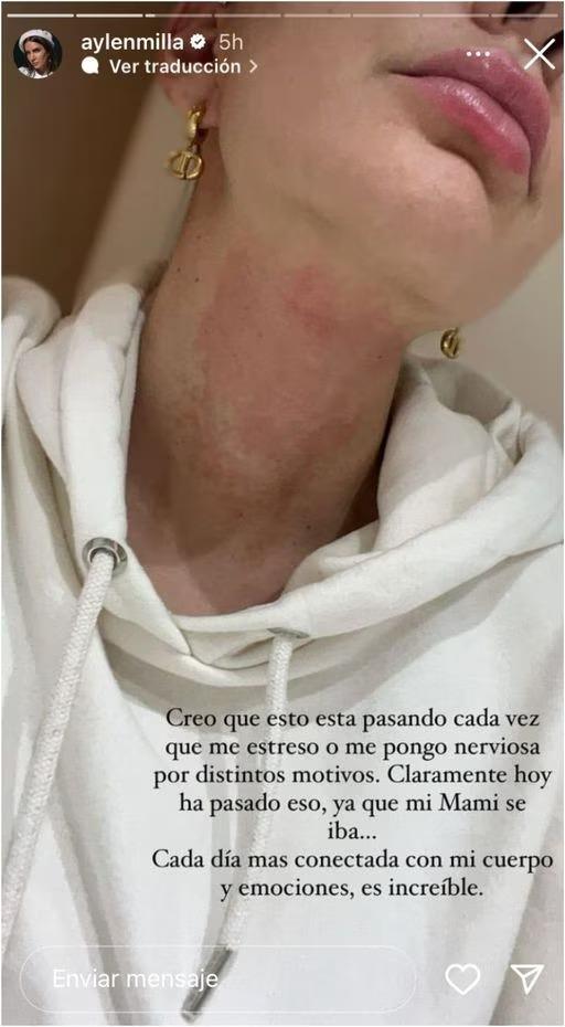 Reacción de Aylén Milla