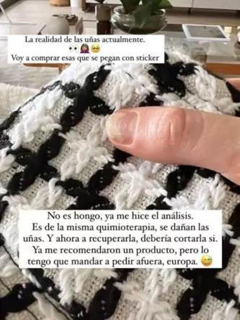 Aylén Milla muestra avance en su lucha contra el cáncer