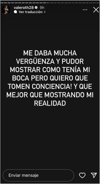 Vale Roth entrega detalles de su operación