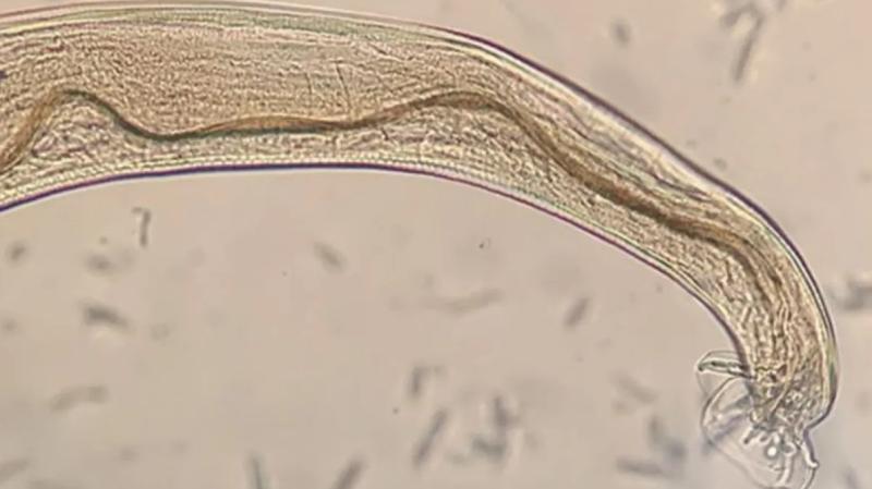 Gusano pulmonar de la rata