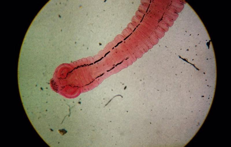 Esto representa a una tenia