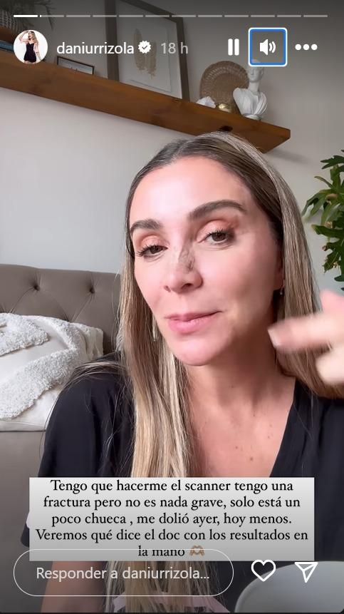Daniela Urrizola se fracturó la nariz