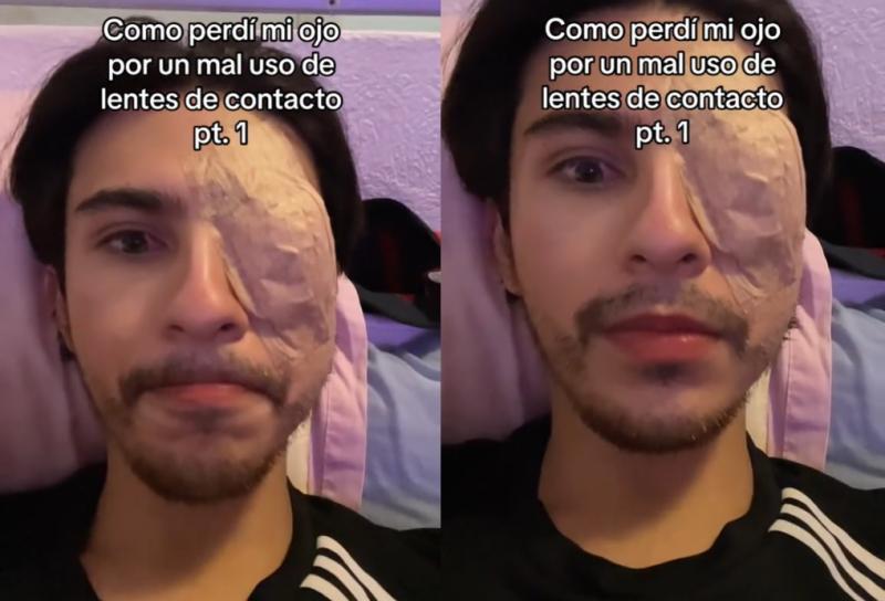 Joven perdió su ojo por una supuesta conjuntivitis