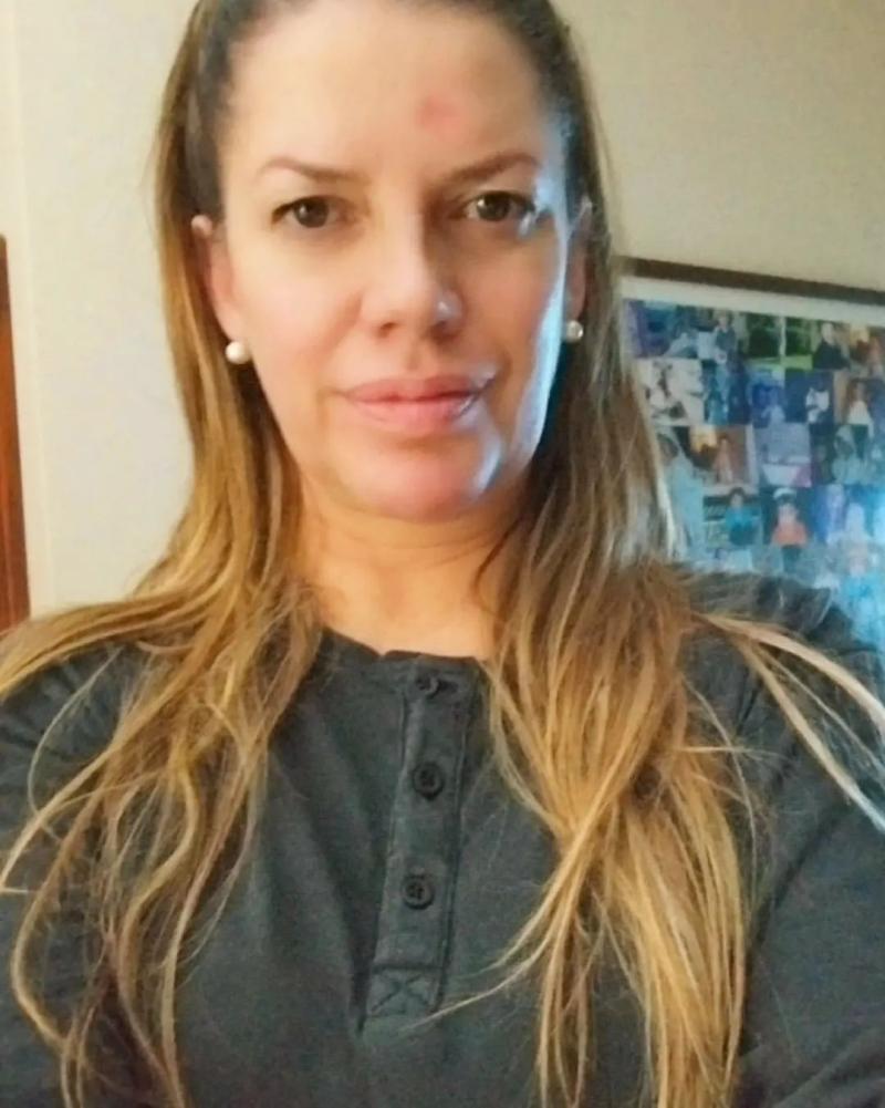 Yulissa del Pino mostró su rostro tras procedimientos por su cáncer