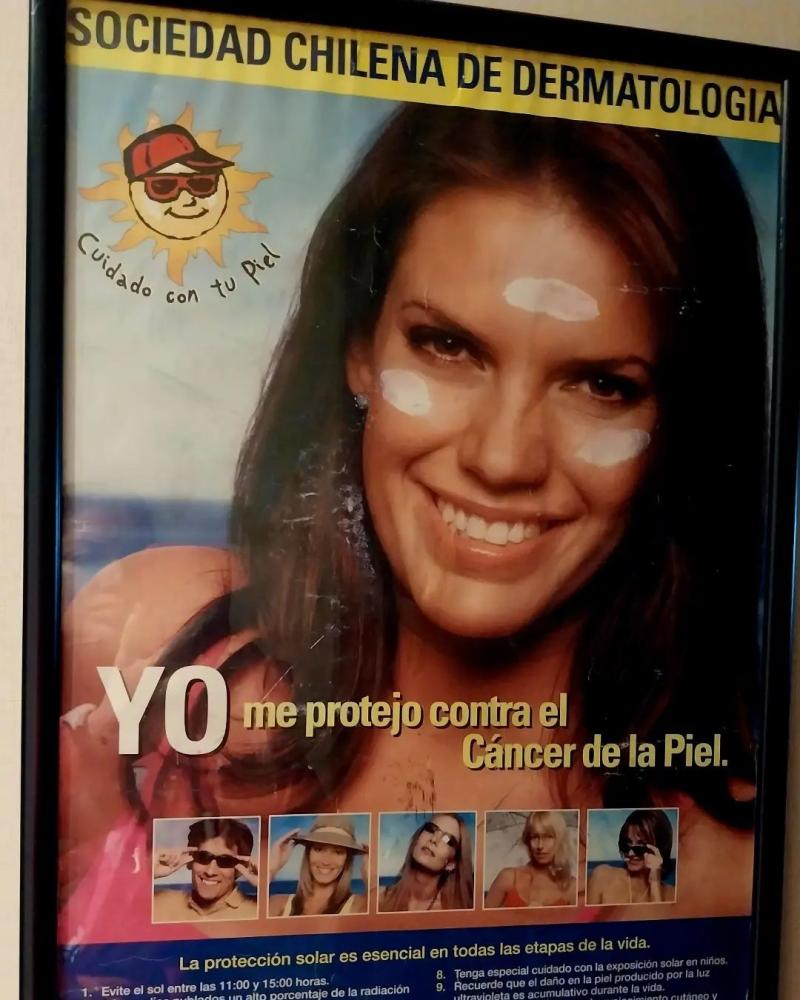 Yulissa del Pino reveló que padece cáncer de piel