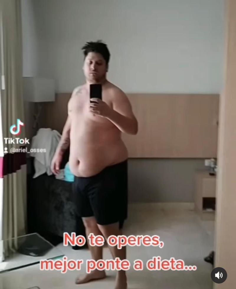 Así lucía Elfi hace un año y medio atrás