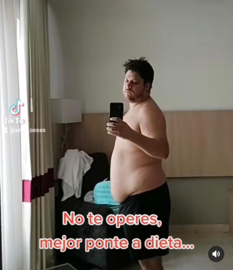 Así lucía Elfi hace un año y medio atrás