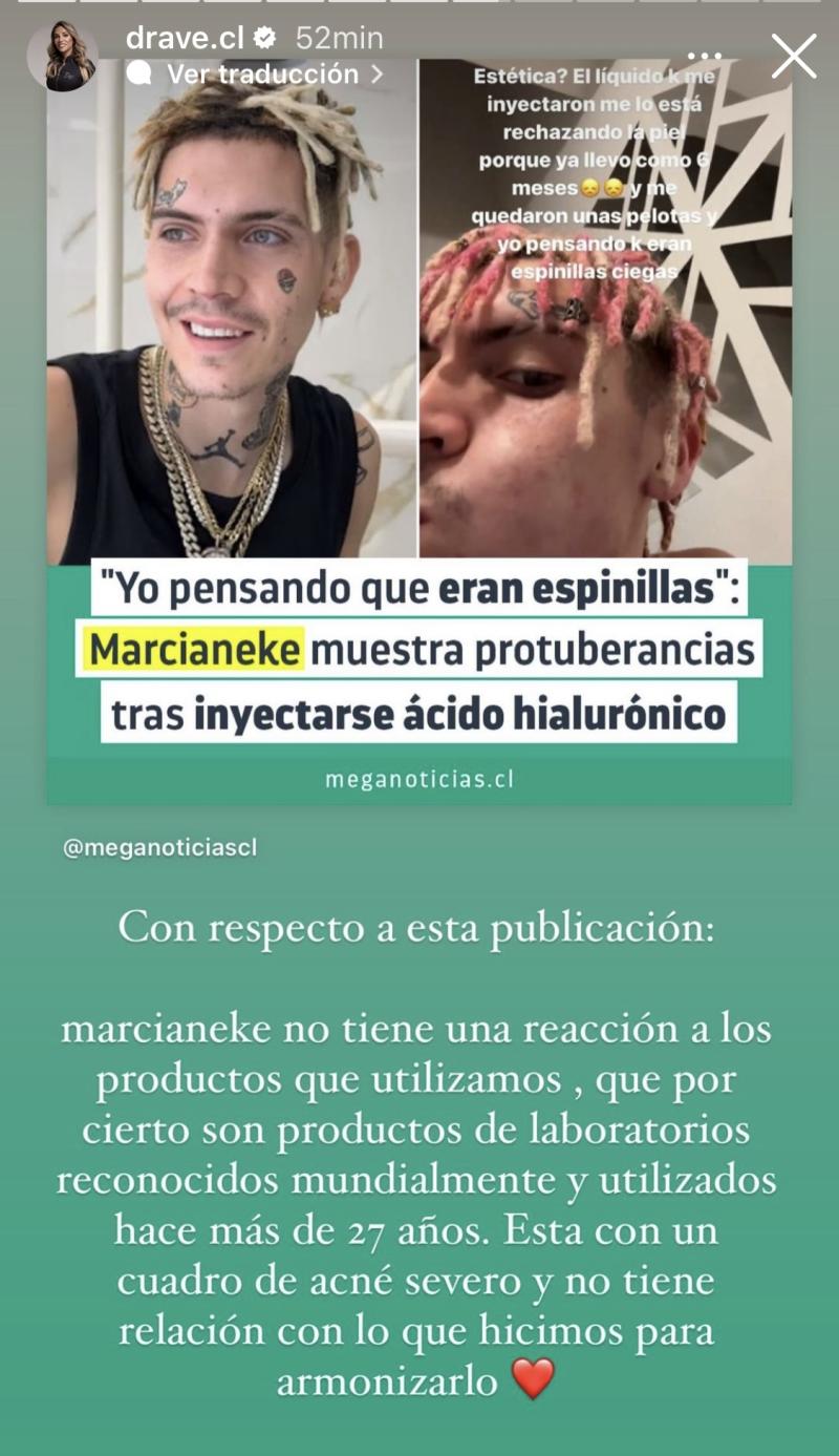 Clínica estética responde a Marcianeke