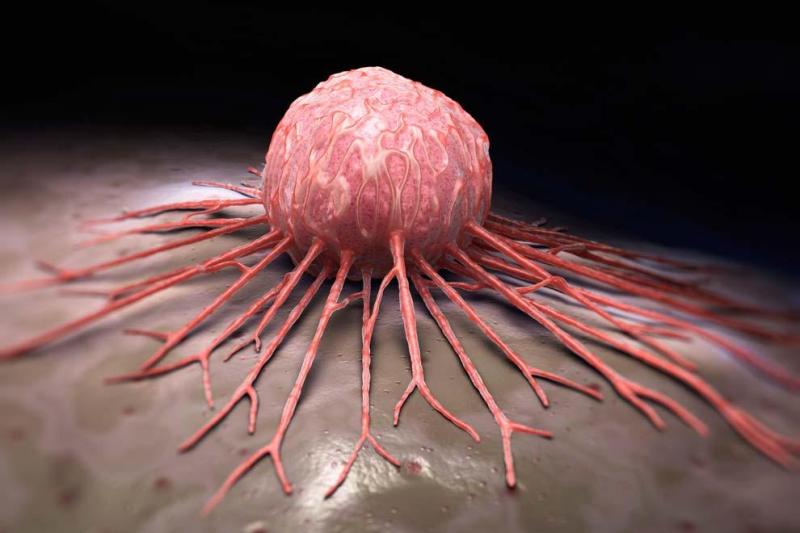 Mieloma múltiple, el cáncer silencioso