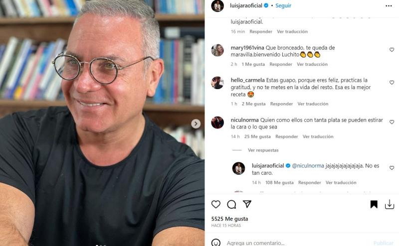 Luis Jara responde por uso de botox