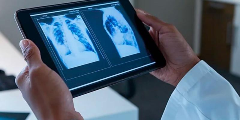 Inteligencia Artificial en la medicina