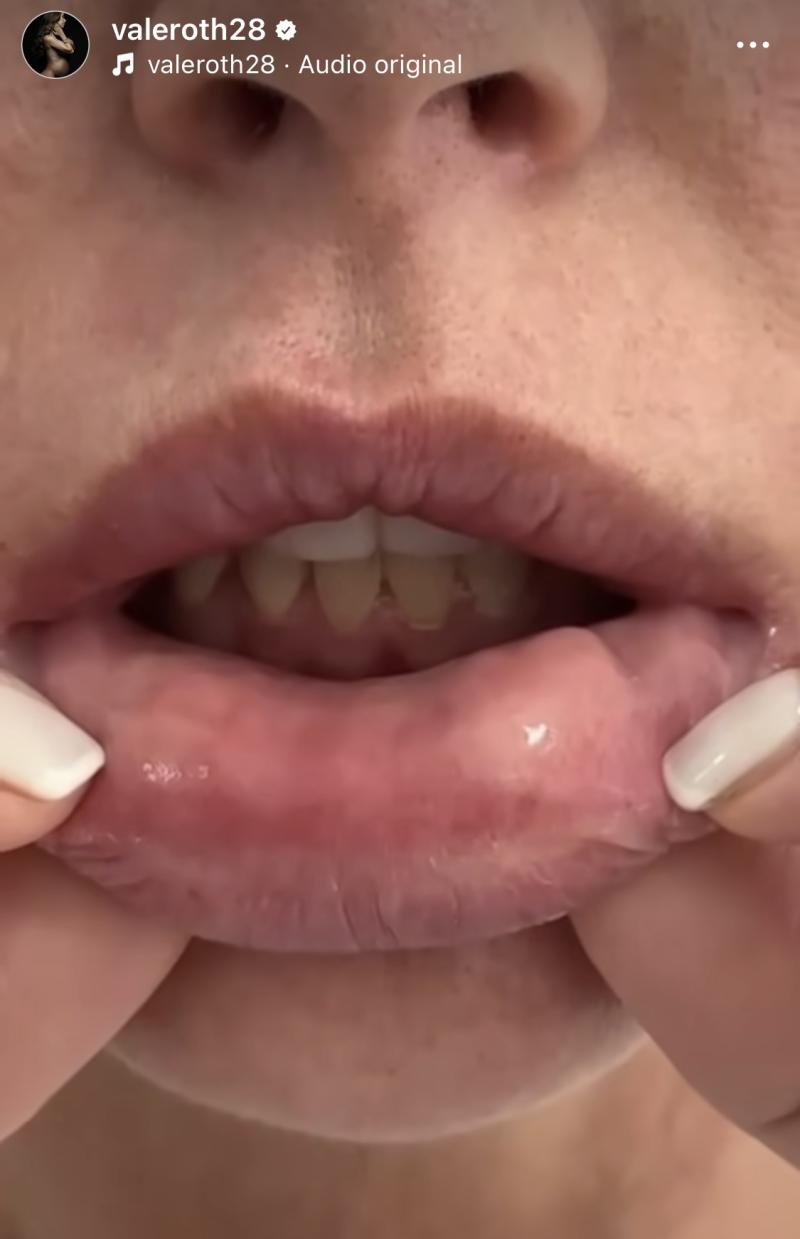 Vale Roth - Instagram