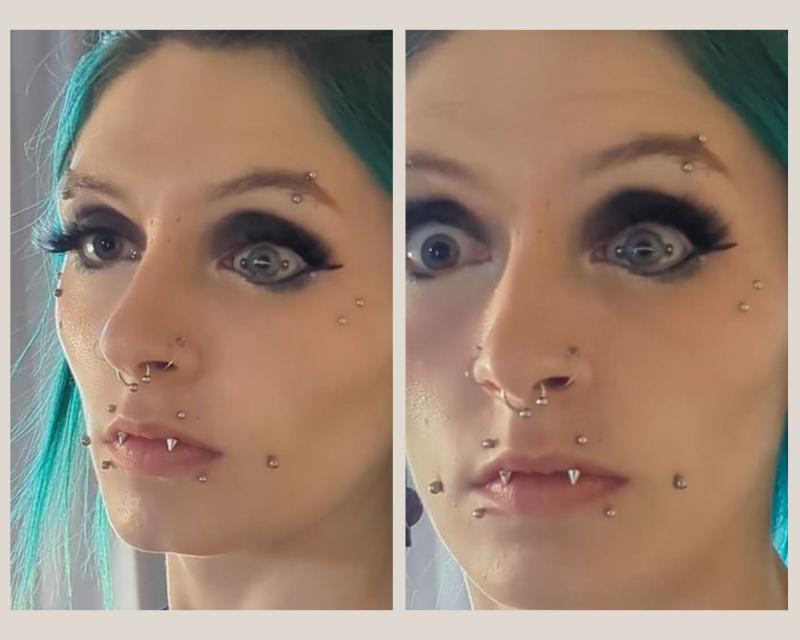 “Me instaron a que me extirparan el ojo”: joven se hizo viral por hacerse un piercing en un ojo