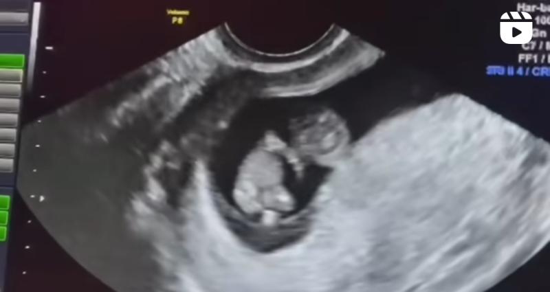 Manuel de Tezanos y Camila Muñoz serán padres por segunda vez