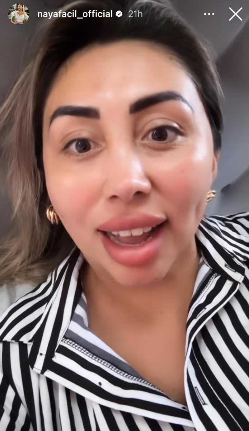 Naya Fácil viajó a Colombia para someterse a una nueva cirugía estética