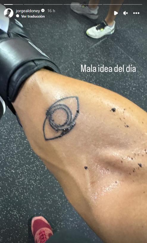 Jorge Aldoney muestra su tatuaje mal cuidado
