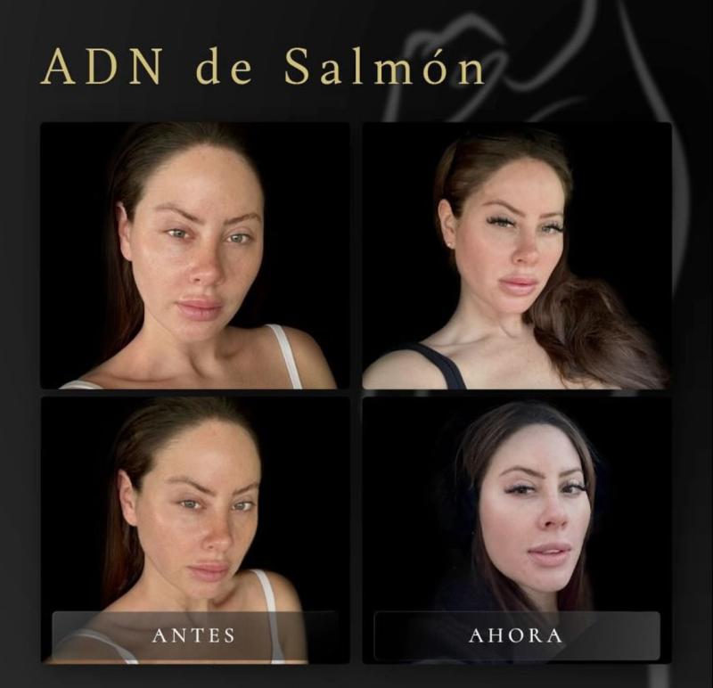 Ignacia Michelson - Instagram