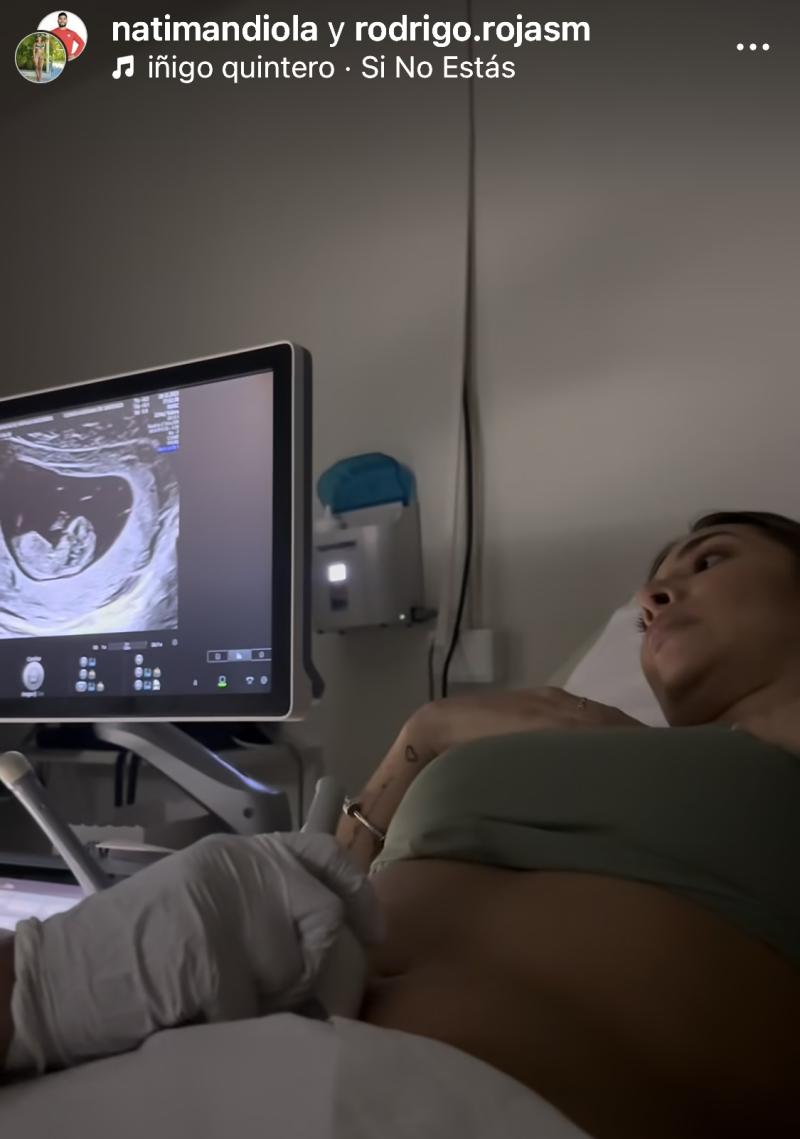 Natalia Mandiola y Rodrigo Rojas serán padres