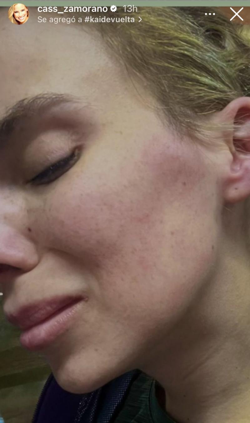 Cass Zamorano - Instagram