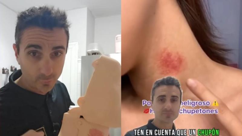 Experto advirtió del peligro de los "chupones"