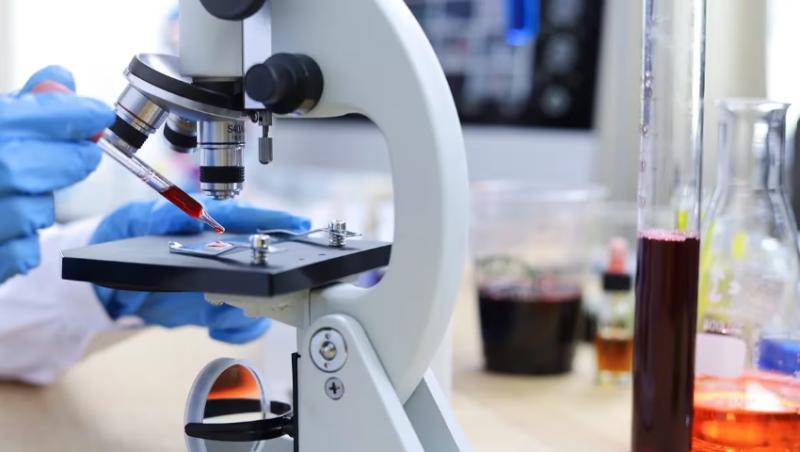 Estudio asegura que se podría predecir el Alzheimer. Créditos: Getty Images