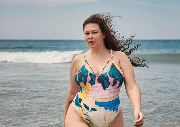 Michelle Carvalho fue diagnosticada con alopecia. (Instagram)