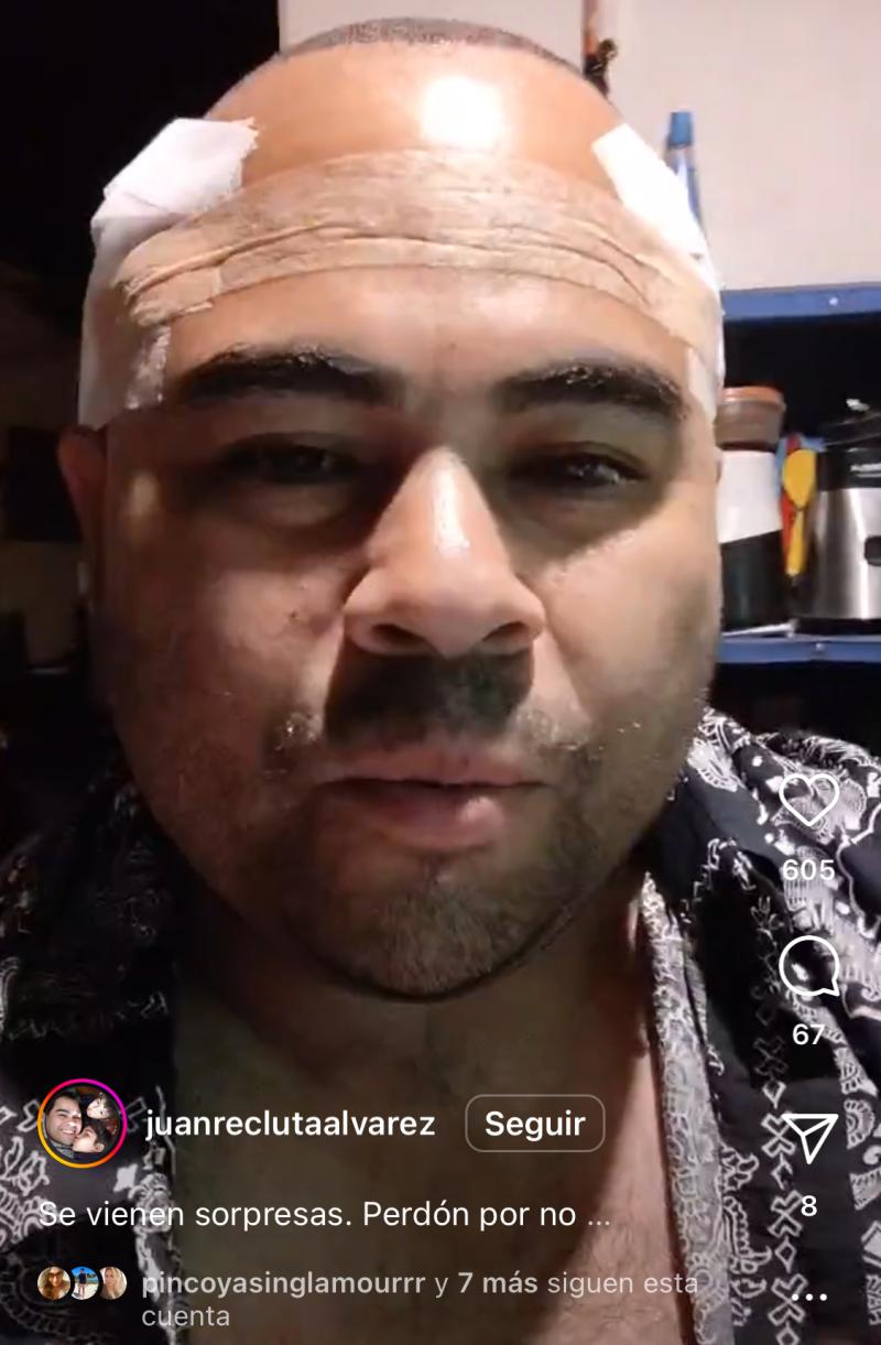 Juan Pablo Álvarez - Instagram
