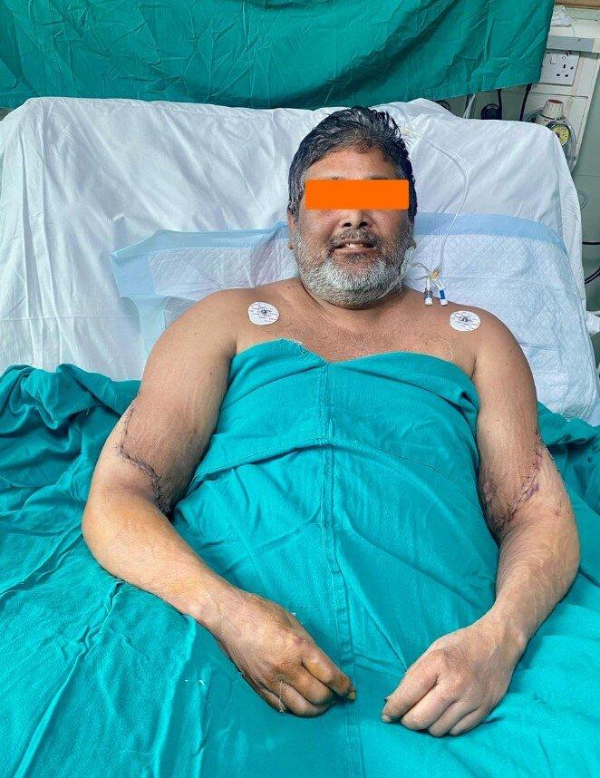 Pintor tras la operación. Créditos: ATLAS