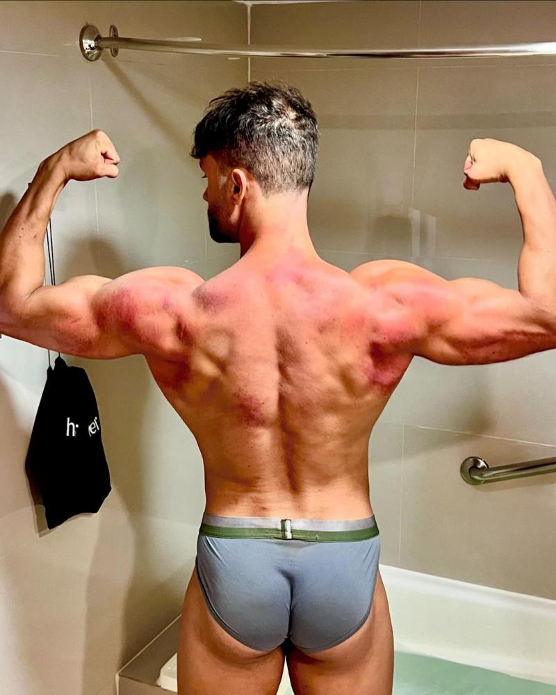 Fabio Agostini exhibe su espalda tras la competencia de Tierra Brava