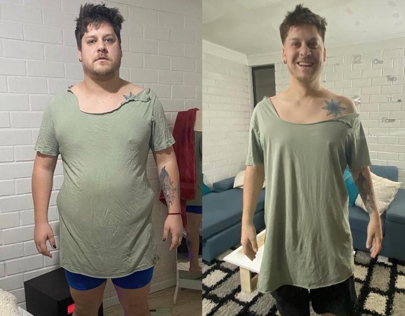 Ariel Osses perdió más de 60 kilos tras someterse a bypass gástrico.