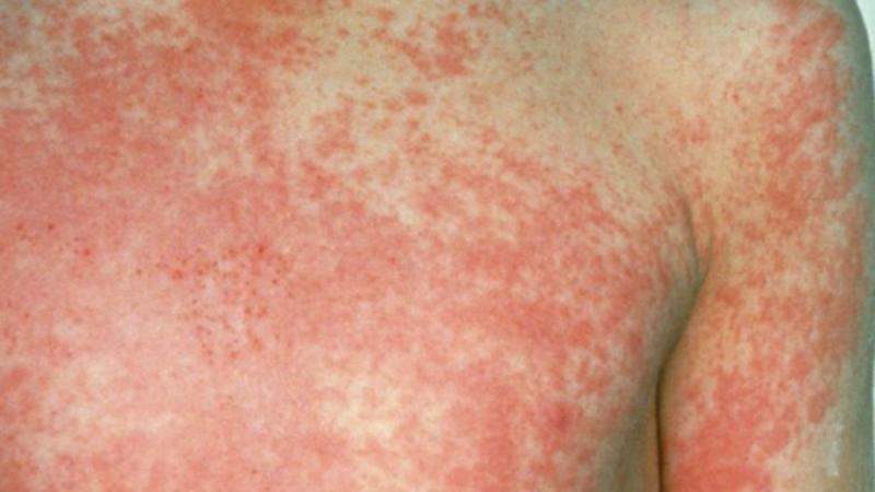 Imagen referencial. Créditos: Getty Images