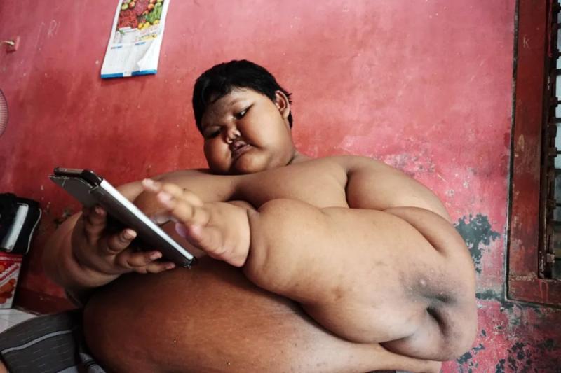 "El niño más gordo del mundo" en su infancia - Créditos: The Sun - AFP