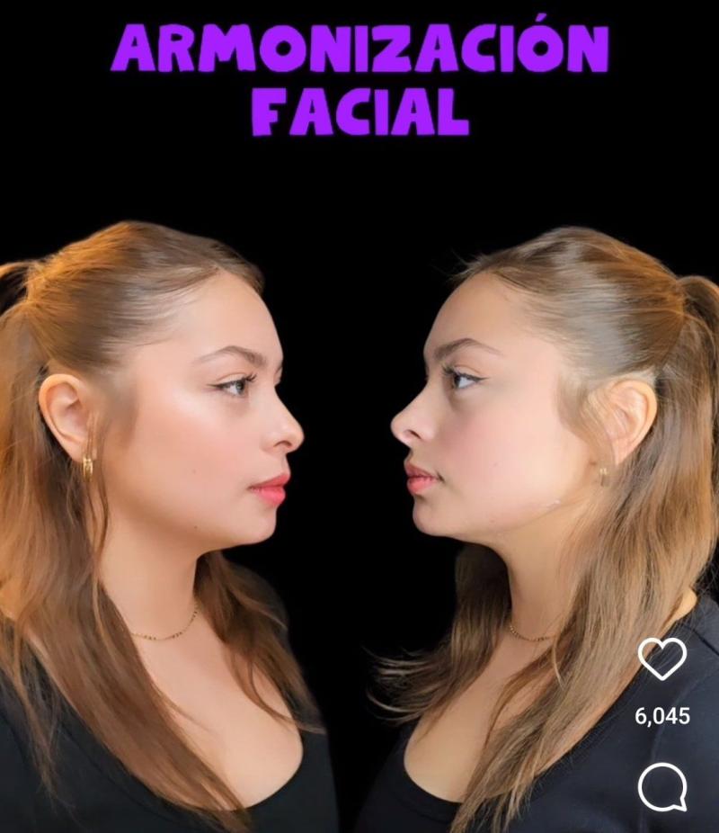 Skarleth Labra se sometió a nuevo procedimiento estético en su rostro. (Tiktok)
