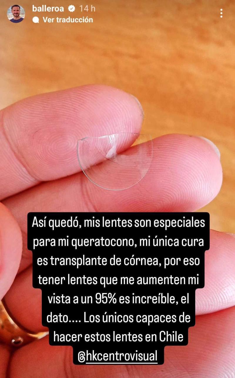 Historia de Álvaro Ballero.