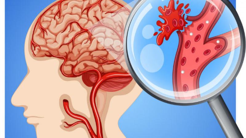 Imagen referencial. Créditos: Getty Images